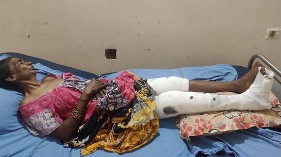 Bà lão gần 70 tuổi thoát chết vì đã đánh bại cá sấu dài hơn 2 mét