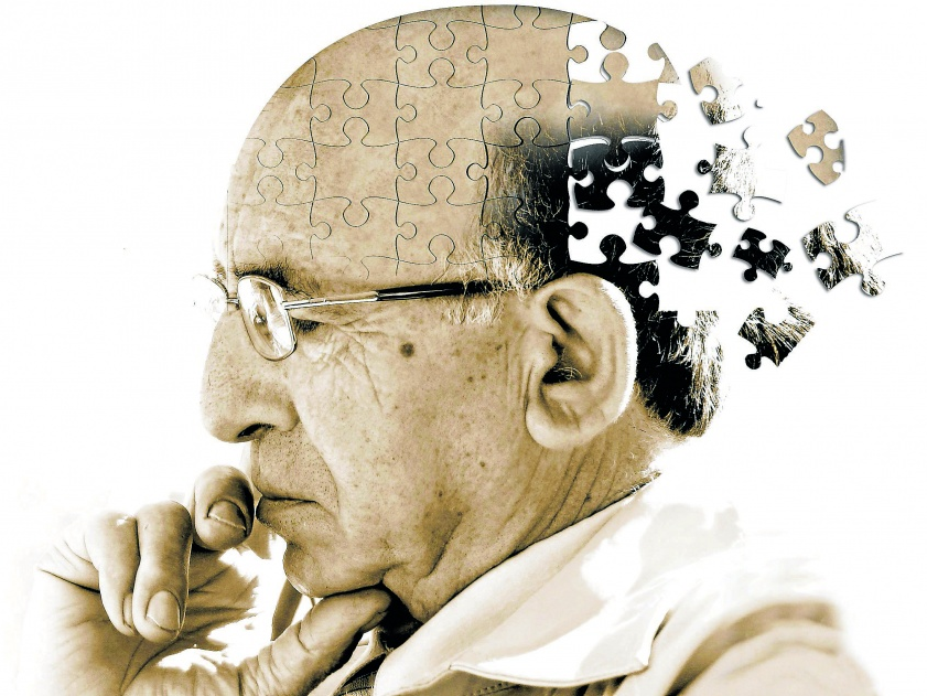 Ô nhiễm không khí có thể dẫn đến bệnh Alzheimer