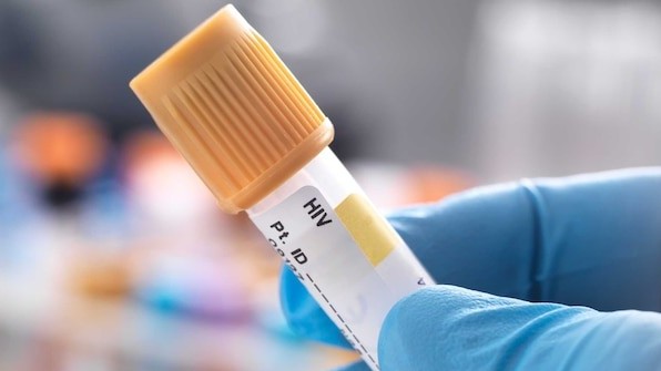 Nữ bệnh nhân đầu tiên trên thế giới được chữa khỏi bệnh HIV