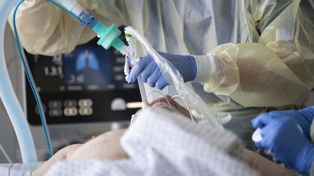 Vì sao nhiều người mắc Covid-19 nặng hơn người khác?