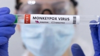Bệnh đậu mùa khỉ: Việt Nam tăng cường kiểm dịch y tế khu vực biên giới