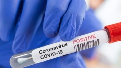 Các biến thể Covid-19 mới có tiếp tục xuất hiện và nguy hiểm hơn?