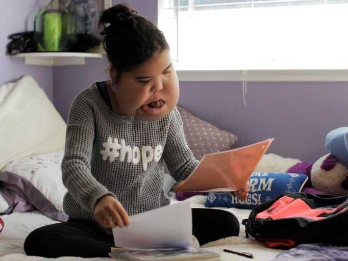 16 năm mang khối u khổng lồ trên mặt vẫn nuôi ước mơ làm y tá