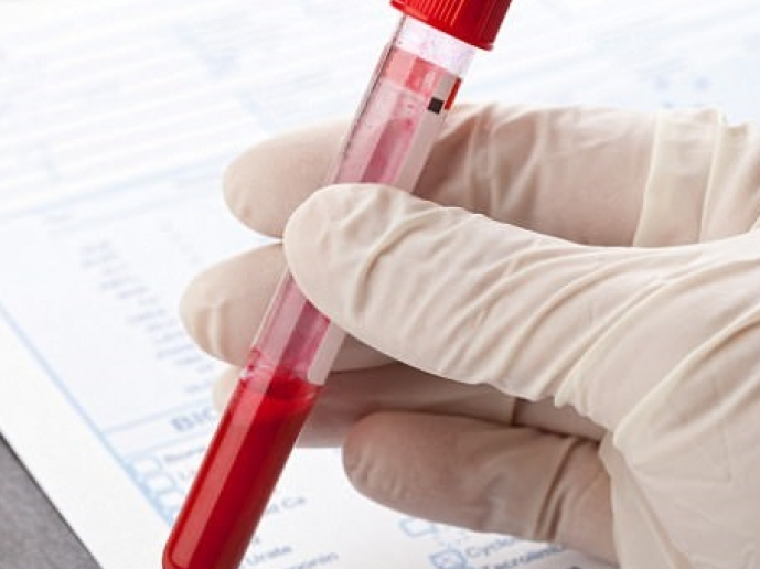 Phương pháp xét nghiệm máu mới giúp phát hiện ung thư từ rất sớm