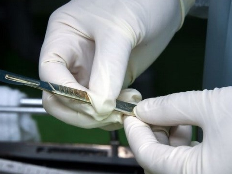 Hy hữu bác sỹ tháo bỏ quả thận của bệnh nhân vì nhầm tưởng là khối u