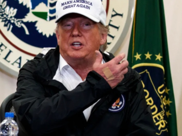 Nhà Trắng giải thích về miếng băng vết thương trên tay Tổng thống Trump