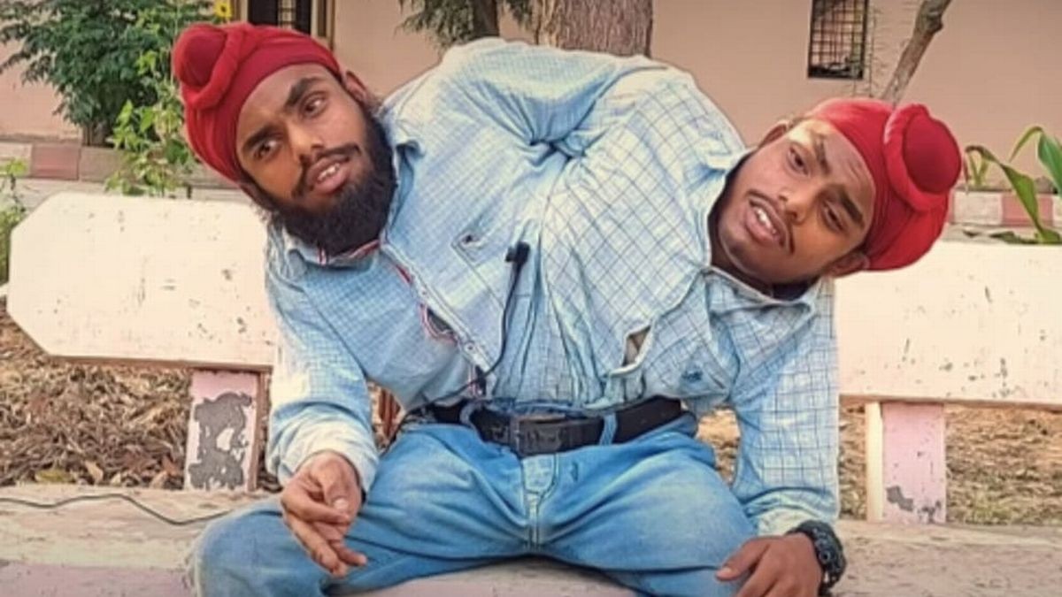 Ấn Độ: Nghị lực phi thường của cặp song sinh dính liền để có công việc mơ ước