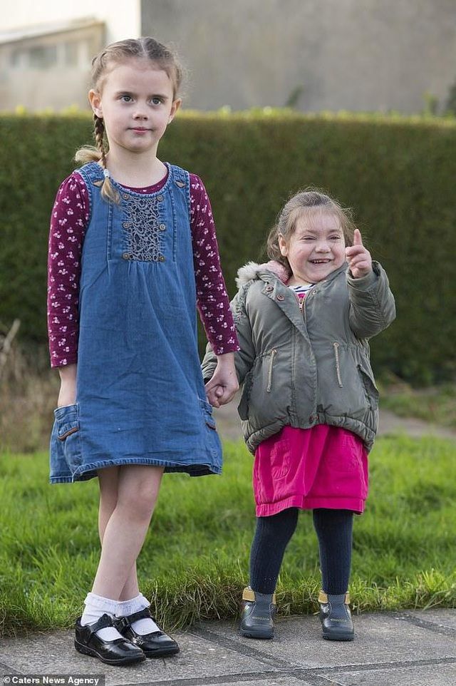 Bé 4 tuổi mắc bệnh siêu hiếm cả thế giới chỉ có 30 người be 4 tuoi mac benh sieu hiem ca the gioi chi co 30 nguoi