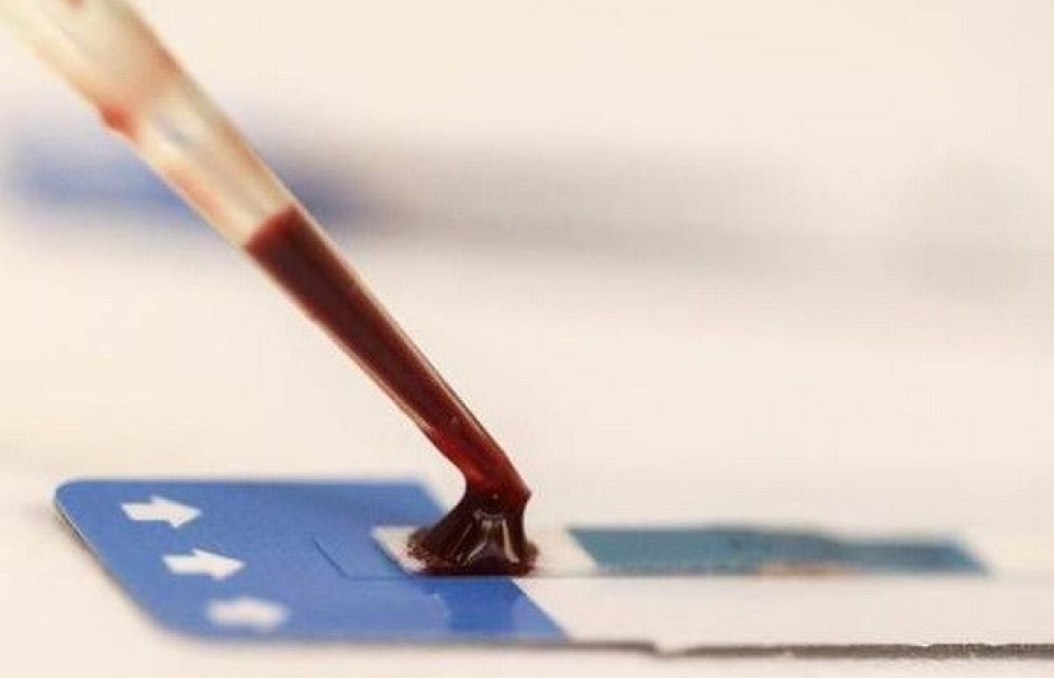 Phát triển phương pháp chẩn đoán nhanh và điều trị bệnh lao phổi