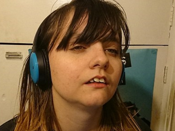 Cô gái mắc chứng bệnh lạ cần ngủ đến 21 tiếng một ngày