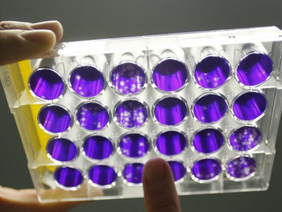 Mỹ tham vọng phát triển công nghệ "làm chậm cái chết"