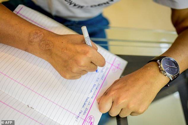 Kỳ lạ đôi bàn tay đàn ông được cấy ghép vào phụ nữ biến đổi thành 'nữ tính' ky la doi ban tay dan ong duoc cay ghep vao phu nu bien doi thanh nu tinh