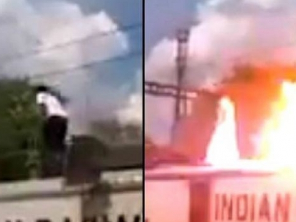 Chàng trai Ấn Độ sống sót sau khi bị điện giật cháy người