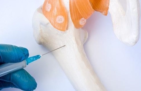 Nga thử nghiệm cấy ghép xương bằng kỹ thuật tế bào thế hệ mới
