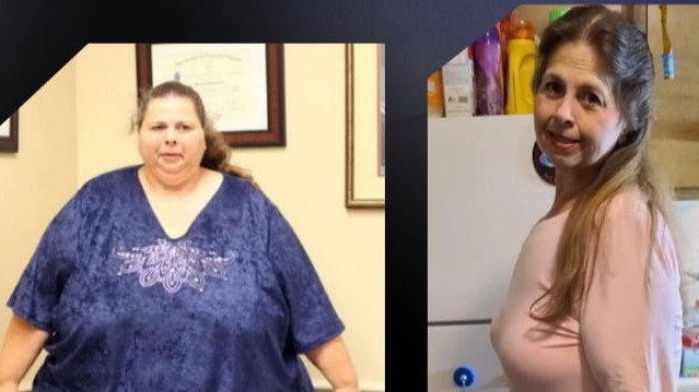 Người phụ nữ từng béo nhất thế giới giảm cân thành công qua 10 năm