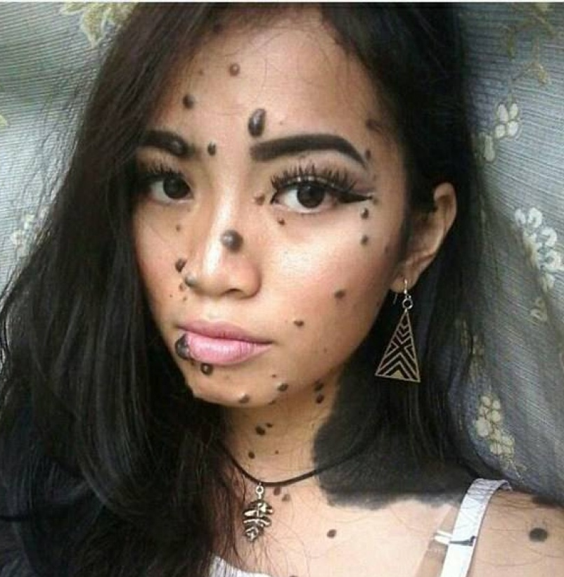 Cô gái có nốt ruồi khắp người tự tin thi Hoa hậu Hoàn vũ