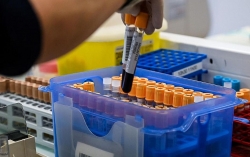 Pháp: Thị trấn hẻo lánh xét nghiệm Covid-19 cho toàn bộ cư dân vì tò mò