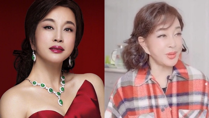 Diễn viên Lưu Hiểu Khánh nói gì trước thông tin phẫu thuật thẩm mỹ