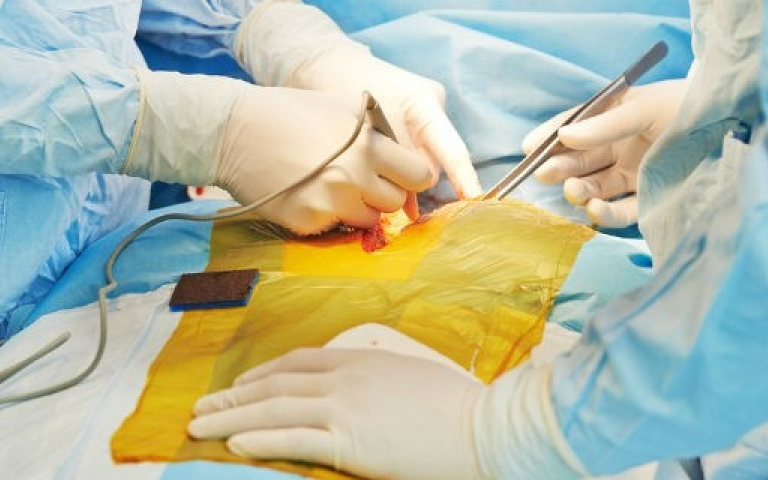 Italy thực hiện ca cấy ghép thực quản nhân tạo đầu tiên trên thế giới