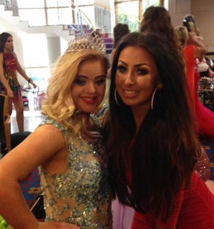 Cô gái mắc hội chứng Down đầu tiên giành giải nhan sắc quốc tế