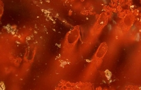 Vi sinh vật tìm thấy ở Kamchatka giúp điều trị khối u