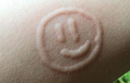 Độc đáo ý tưởng biến bệnh lý thành nghệ thuật