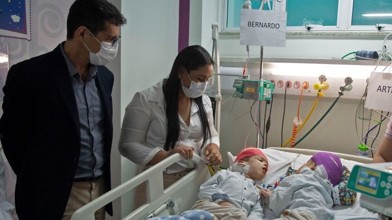 Brazil phẫu thuật thành công ca tách rời cặp song sinh dính liền đầu và não