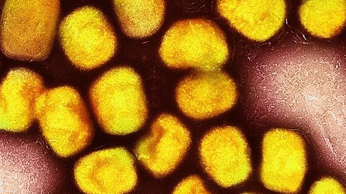 Bệnh đậu mùa khỉ ở châu Mỹ: Bolivia truy vết 'bệnh nhân số 0'