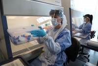 Nghiên cứu mới về những triệu chứng kéo dài hậu Covid-19