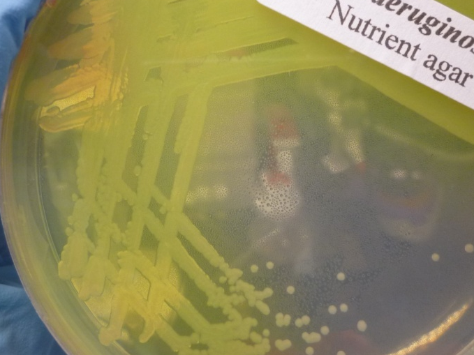 Lý giải nguyên nhân các vết thương lâu lành