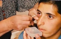 be 4 tuoi mac benh sieu hiem ca the gioi chi co 30 nguoi