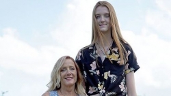 Cô gái 17 tuổi sở hữu đôi chân dài nhất thế giới