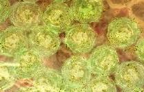 Phương pháp điều trị HIV kiểu mới nhờ… bệnh sốt rét