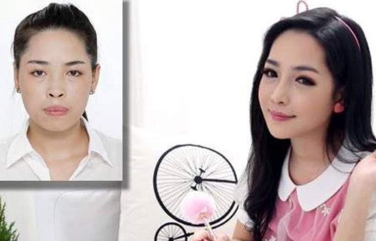 "Thay đổi cuộc sống" cho các bạn trẻ có khiếm khuyết về ngoại hình