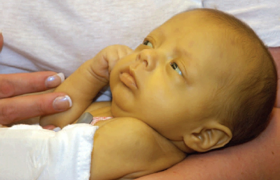 WHO sẽ gửi 3,5 triệu liều vắcxin chống sốt vàng da tới Brazil