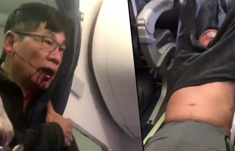 United Airlines đạt thỏa thuận bồi thường với bác sĩ David Dao