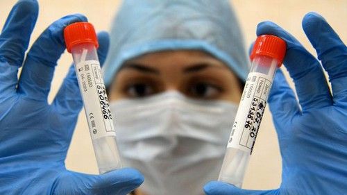 nga chuan bi ra mat vaccine covid 19 moi len ke hoach vao cuoi nam