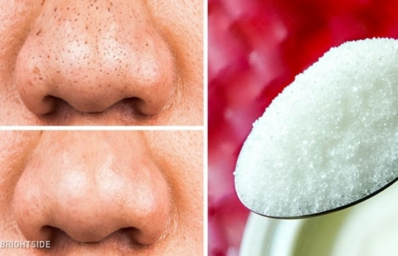 12 thứ có sẵn trong nhà giúp làn da phụ nữ trẻ mãi