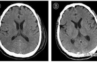ha lan tim ra khang the chong virus sars cov 2