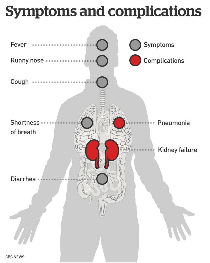10 phat hien moi nhat ve cac trieu chung mac covid 19