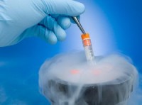 uong aspirin deu dan giam nguy co mac ung thu gan va buong trung