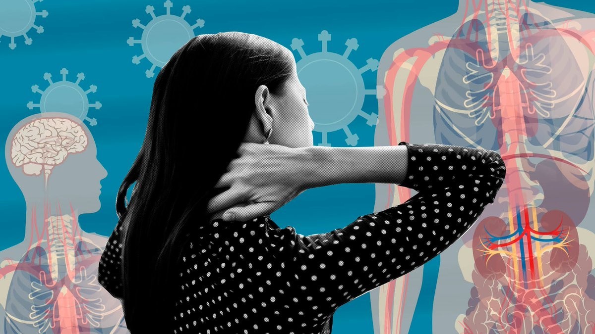 Di chứng hậu Covid-19 phổ biến và cách điều trị