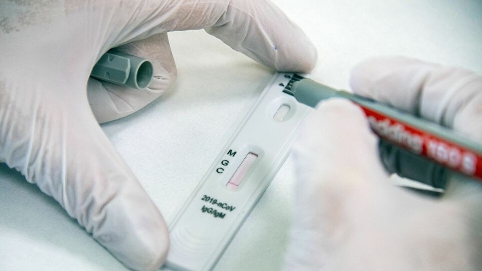 Nga phát triển dụng cụ đo kháng thể đối với virus SARS-CoV-2 tại nhà