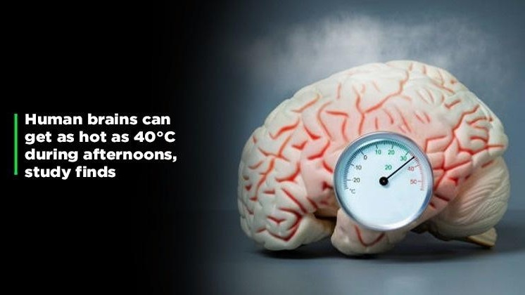 Bản đồ 4D đầu tiên về nhiệt độ não người