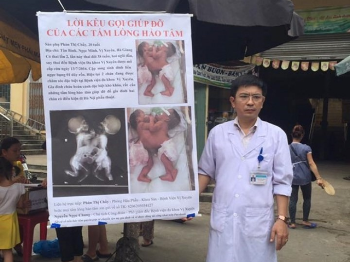 Tặng bằng khen cho bác sĩ quyên góp tiền cứu 2 bé song sinh dính liền