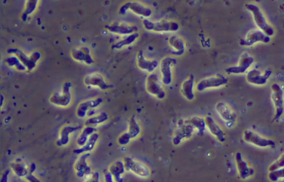 Chế tạo thành công vaccine phòng bệnh amip