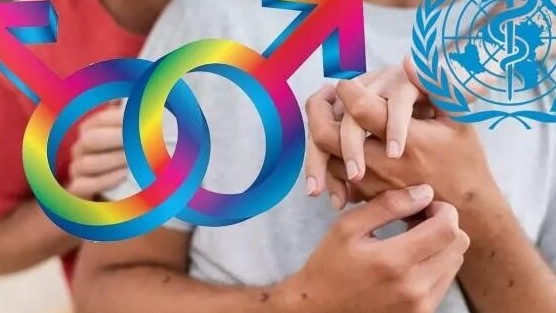 Bệnh đậu mùa khỉ và những điểm cần lưu ý